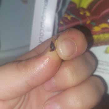 Çikolatanın İçinden Çıkan Kabuk Güvenimizi Sarstı