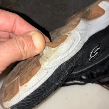 Skechers Ayakkabıda Kısa Sürede Aşırı Yıpranma ve Hayal Kırıklığı