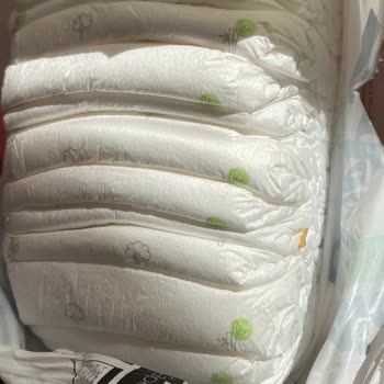 Bebek Bezinde Kurtçuk: Hijyen Sorunu Ve Yetersiz Müşteri İlgisi