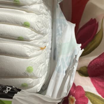 Bebek Bezinde Kurtçuk: Hijyen Sorunu Ve Yetersiz Müşteri İlgisi