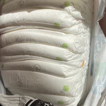 Bebek Bezinde Kurtçuk: Hijyen Sorunu Ve Yetersiz Müşteri İlgisi