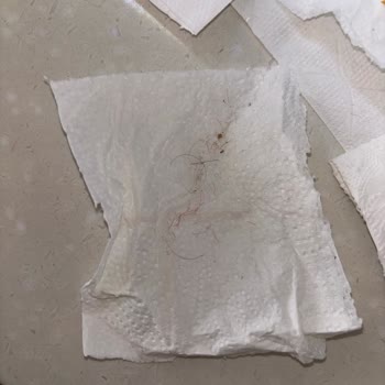 Vileda Mop Sürekli Tüy Döküyor, Müşteri Hizmetlerine Ulaşılamıyor!