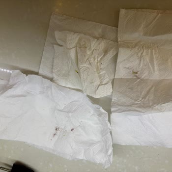 Vileda Mop Sürekli Tüy Döküyor, Müşteri Hizmetlerine Ulaşılamıyor!