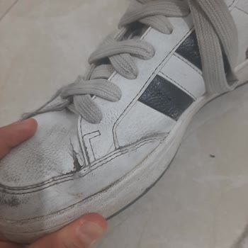 Kısa Sürede Deforme Olan Ayakkabı İçin İade Talebimin Reddedilmesi Hayal Kırıklığı Yarattı