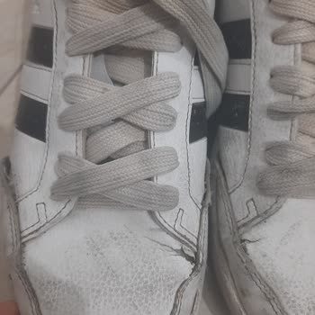 Kısa Sürede Deforme Olan Ayakkabı İçin İade Talebimin Reddedilmesi Hayal Kırıklığı Yarattı