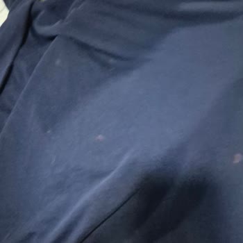 Renkliler İçin Güvenli Denilen Ürün Kıyafetlerimi Geri Dönüşsüz Şekilde Bozdu