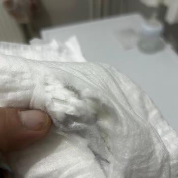 Molfix Bebek Bezinde Sert Ve Tehlikeli Yabancı Madde Endişesi