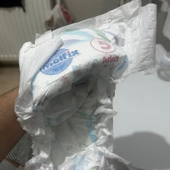 Molfix Bebek Bezinde Sert Ve Tehlikeli Yabancı Madde Endişesi