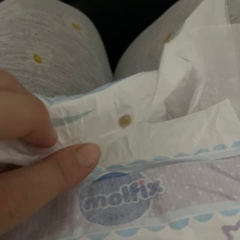 Molfix Bebek Bezinde Yabancı Maddeyle Hayal Kırıklığı