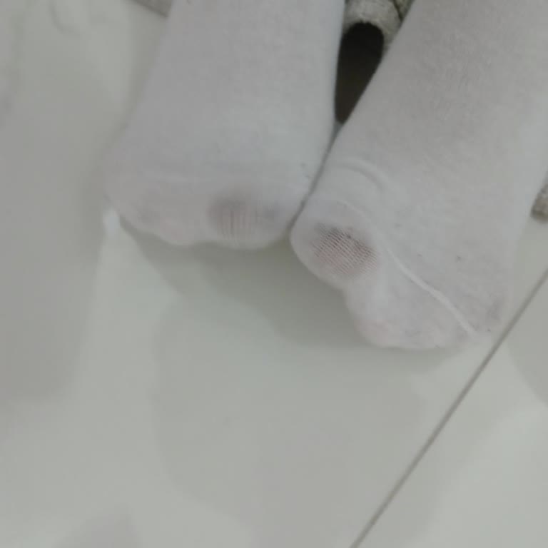 Skechers Ayakkabıda Boya Sorunu Ve Yetersiz Garanti Hizmeti