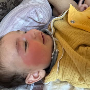 Bebek Havlusu Yüzde Kızarıklık Yaptı, Güvenim Sarsıldı