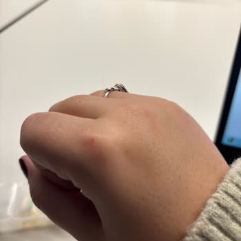 Kırık Gelen Parfüm Ve Yetersiz Müşteri Hizmeti Nedeniyle Mağduriyet Ve Telafi Talebi