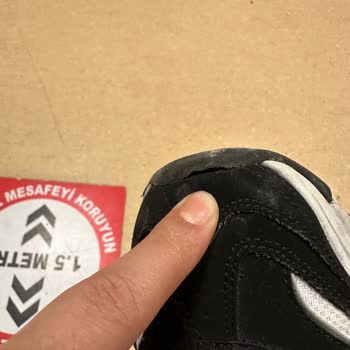 Skechers Ayakkabıda Açılma Sorunu Ve Yetersiz Değişim Süreci: Müşteri Güveni Zedeleniyor