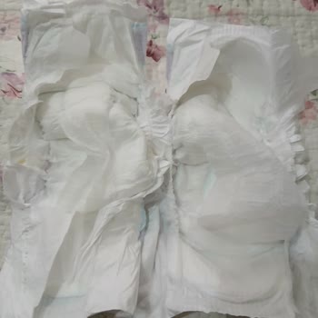 Molfix 5 Numara Bezlerde Artan Kalite Sorunu Ve Cilt Rahatsızlığı