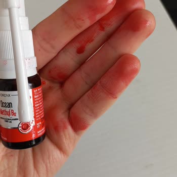 Aldığım Balık Yağı Ve B12 Sprey Ürünlerinde Tazelik Ve Kalite Sorunu