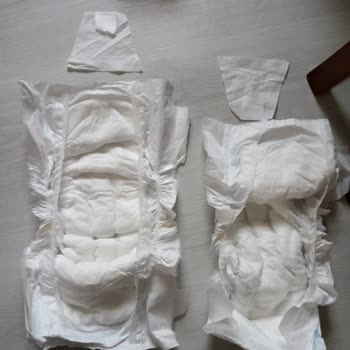 Molfix Bebek Bezinde Yoğun Yapıştırıcı Kokusu Ve Kopan Bantlar Mağduriyet Yaşattı