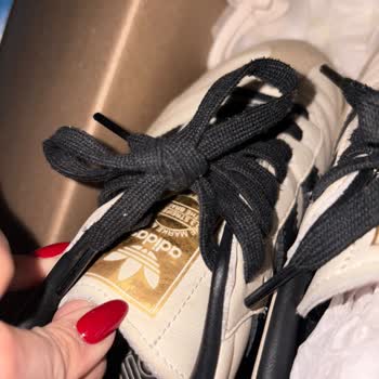 Kısa Sürede Deforme Olan Adidas Ayakkabı Ve Yetersiz İnceleme Süreci