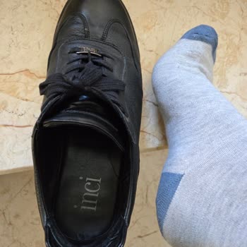 Aldığım Ayakkabı Çoraplarımı Boyuyor, Mağaza Çözüm Sunmuyor!