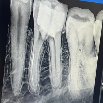 Adana Başkent Hastanesi Diş Polikliniğinde Bilgilendirme Eksikliği Ve Hatalı Tıbbi İşlem
