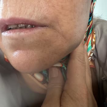 Adana Başkent Hastanesi Diş Polikliniğinde Bilgilendirme Eksikliği Ve Hatalı Tıbbi İşlem