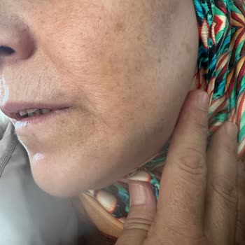 Adana Başkent Hastanesi Diş Polikliniğinde Bilgilendirme Eksikliği Ve Hatalı Tıbbi İşlem