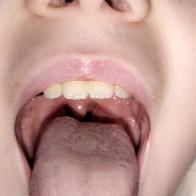 Superfresh Pizza Tost Ürününde Yabancı Madde: Çocuğumun Sağlığı Tehlikeye Girdi