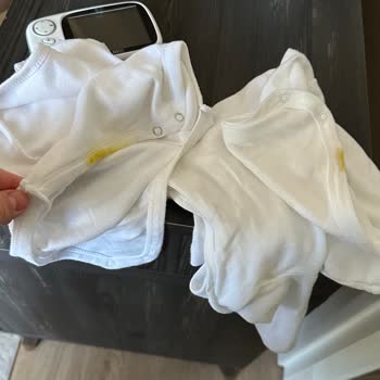 Molfix Premium Care Bebek Bezi Sızdırma Ve Yetersiz Koruma Sorunu