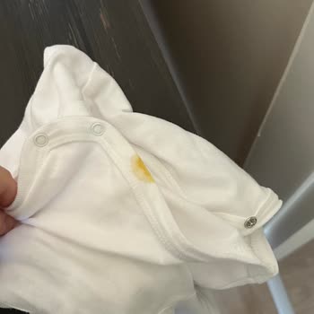 Molfix Premium Care Bebek Bezi Sızdırma Ve Yetersiz Koruma Sorunu