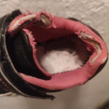 Çocuk Ayakkabısında Hızlı Deformasyon Ve Yetersiz Müşteri Desteği