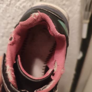 Çocuk Ayakkabısında Hızlı Deformasyon Ve Yetersiz Müşteri Desteği