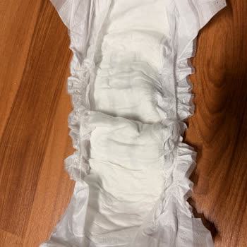 Yeni Ambalajlı Sleepy Bebek Bezinde Kalite Düşüşü Ve Sızdırma Sorunu: Özel Gereksinimli Çocuğum İçin Mağduriyet Yaşıyorum