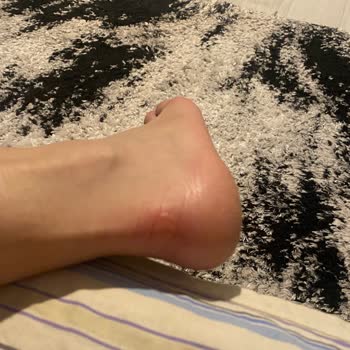 Tören Günü Aldığım Ürünler Nedeniyle Yaşadığım Mağduriyet Ve Para İadesi Talebim