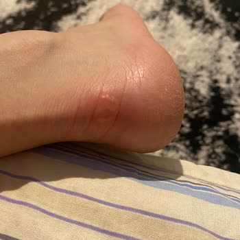 Tören Günü Aldığım Ürünler Nedeniyle Yaşadığım Mağduriyet Ve Para İadesi Talebim