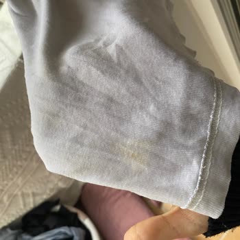 Yeni Siemens Çamaşır Makinesinde Geçmeyen Leke Sorunu Ve İlgisiz Servis