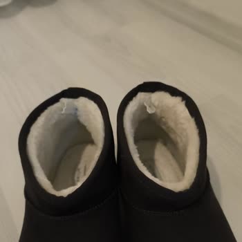 2 Günlük UGG Botta Deformasyon Ve İade Talebimin Gerekçesiz Reddedilmesi