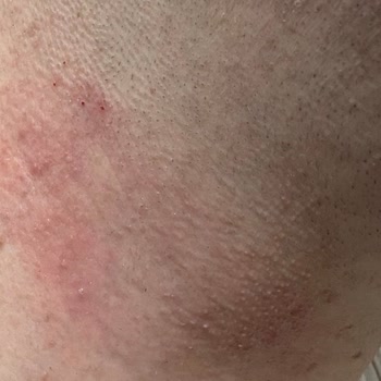 Gillette Mach 3 Tıraş Bıçaklarında Beklenmedik Kalite Sorunu Ve Mağduriyet