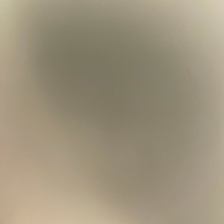 Pronet'te Cayma Bedeli Tutarında Büyük Tutarsızlık Ve Çözüm Eksikliği