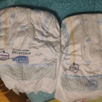 Aynı Paket Farklı Kalite Molfix Bebek Bezi Ciltte Tahriş Ve Sızdırma Sorunu