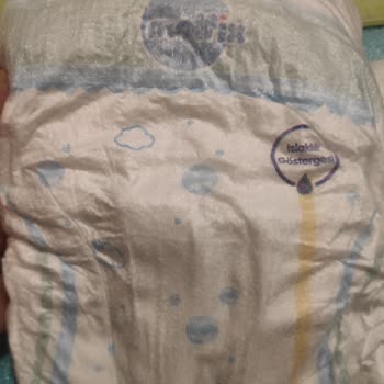 Aynı Paket Farklı Kalite Molfix Bebek Bezi Ciltte Tahriş Ve Sızdırma Sorunu