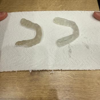 Tedavi Sonrası Dişlerimde Kalıcı Hasar Ve Mağduriyet Yaşıyorum