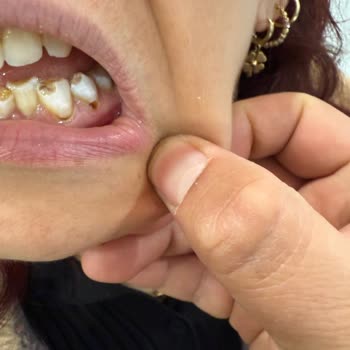 Tedavi Sonrası Dişlerimde Kalıcı Hasar Ve Mağduriyet Yaşıyorum