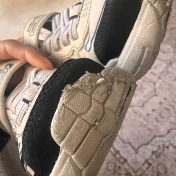 Bir Giyimde Yıpranan Skechers Ürünü Ve İlgisiz Satıcı Deneyimi