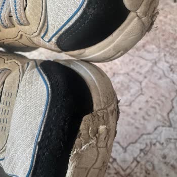 Bir Giyimde Yıpranan Skechers Ürünü Ve İlgisiz Satıcı Deneyimi