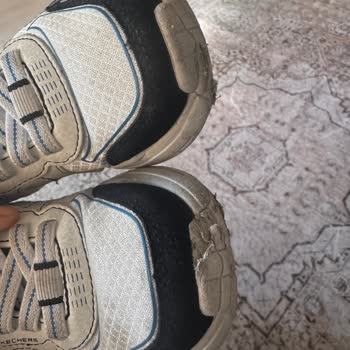 Bir Giyimde Yıpranan Skechers Ürünü Ve İlgisiz Satıcı Deneyimi