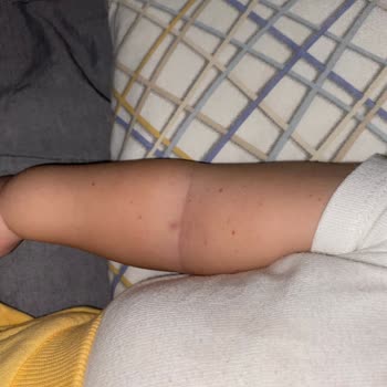 Çayırova Tıp Merkezi Bebeğime Acil Serviste Uygulanan Yanlış Müdahale Ve Personel Yetersizliği!