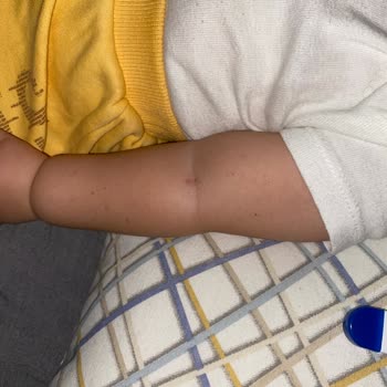 Çayırova Tıp Merkezi Bebeğime Acil Serviste Uygulanan Yanlış Müdahale Ve Personel Yetersizliği!