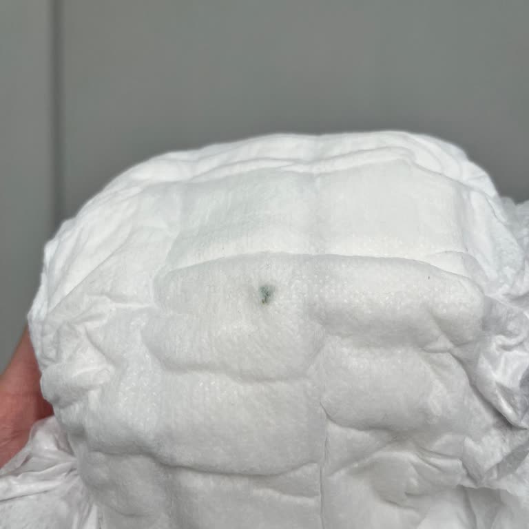 Bebek Bezinde Yabancı Cisim: Sağlık Ve Güvenlik Endişesi