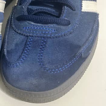 Kısa Sürede Leke Yapan Adidas Ayakkabıma Çözüm Bulamıyorum