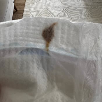 Molfix Bebek Bezinde Yabancı Cisim Endişesi Ve Müşteri Hizmetlerine Ulaşamama