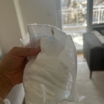 Molfix Bebek Bezinde Yabancı Cisim Endişesi Ve Müşteri Hizmetlerine Ulaşamama